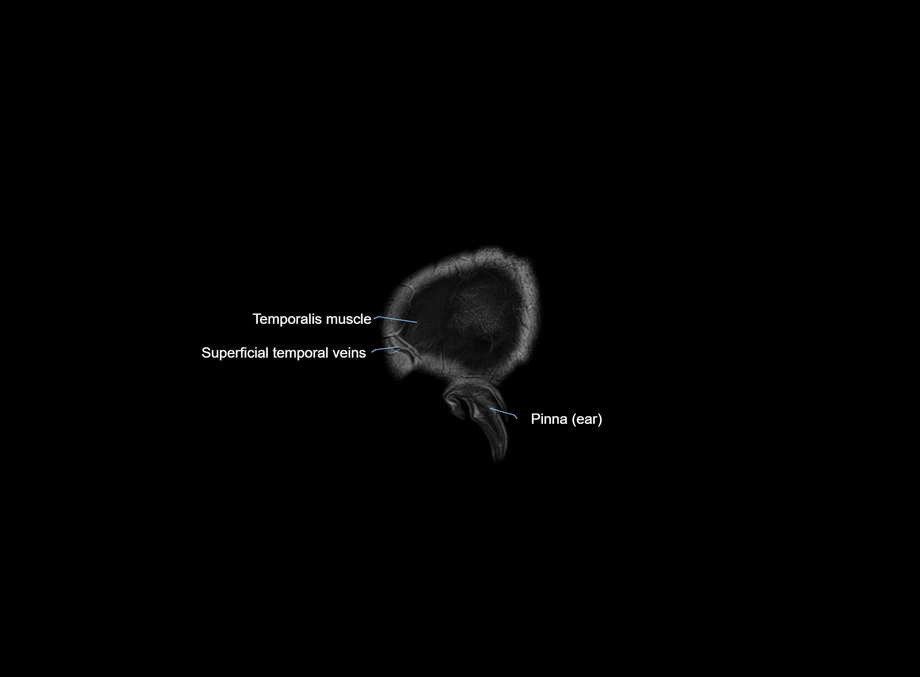 brain sagittal anatomy 3T MRI images -img-00001-00001.webp